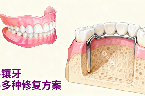 镶牙修复卡通图片展示
