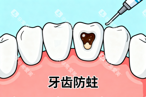 牙齿防蛀卡通图 牙齿防蛀卡通图