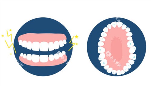 牙齿排列图 牙齿排列图