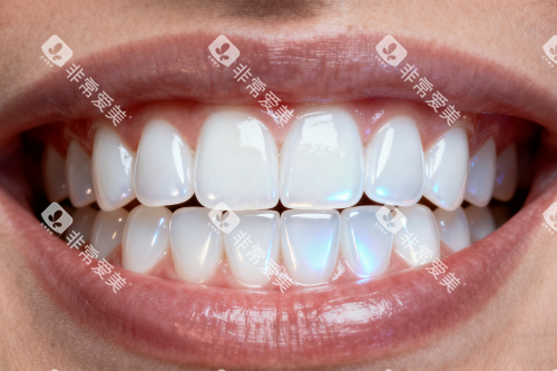 整洁健康牙齿卡通图 整洁健康牙齿卡通图