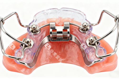 牙齿保持器模型图 牙齿保持器模型图