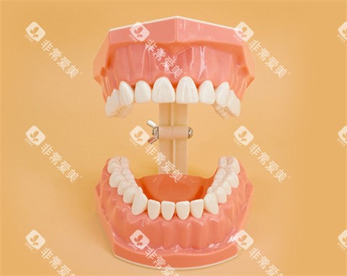 牙齿开口模型 牙齿开口模型