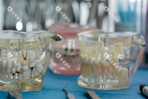 牙齿模型展示图片 牙齿模型展示图片