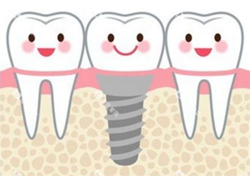 种植牙后动画展示图