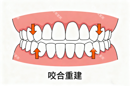牙齿咬合重建卡通展示图