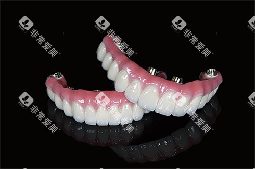 马龙桥全口示意图 马龙桥全口示意图