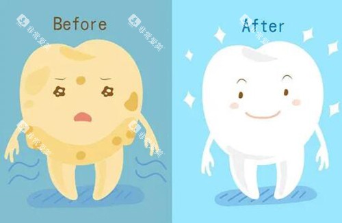 牙齿美白改善图卡通 牙齿美白改善图卡通