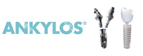 安卓健种植牙宣传图 安卓健种植牙宣传图