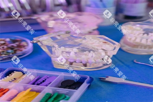 牙齿正畸宣传图