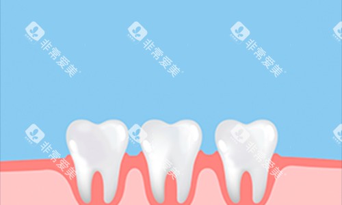 牙齿动画展示图 牙齿动画展示图