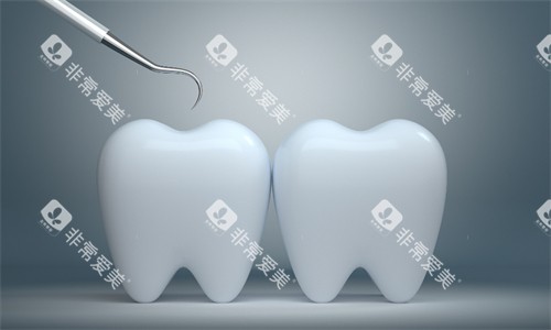 牙齿检查 牙齿检查
