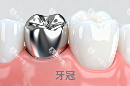 金属牙冠修复卡通图 金属牙冠修复卡通图