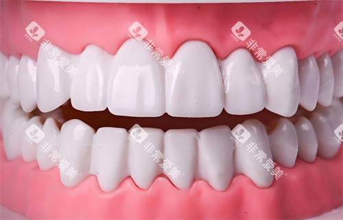 牙齿美白模型