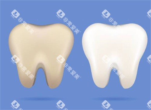 牙齿美白前后图 牙齿美白前后图