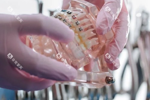 牙齿模型参考图