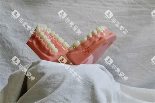 牙齿材料展示图