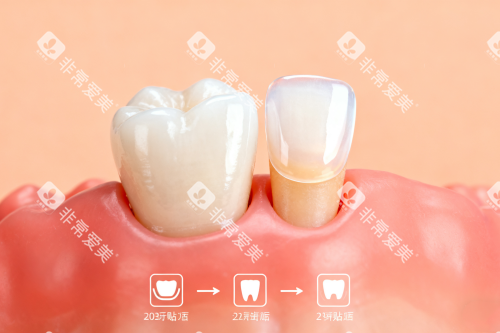 健康牙齿卡通展示图