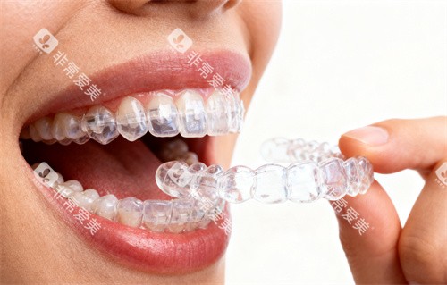 牙齿矫正图片 牙齿矫正图片