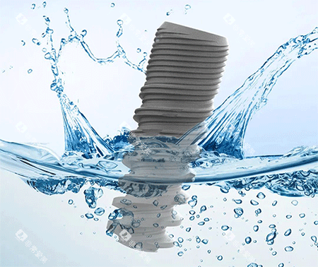 科惠种植牙怎么样 科惠种植牙怎么样