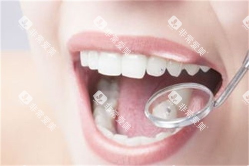 牙齿 牙齿