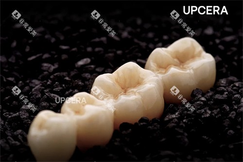 爱尔创-瓷倍健全瓷牙