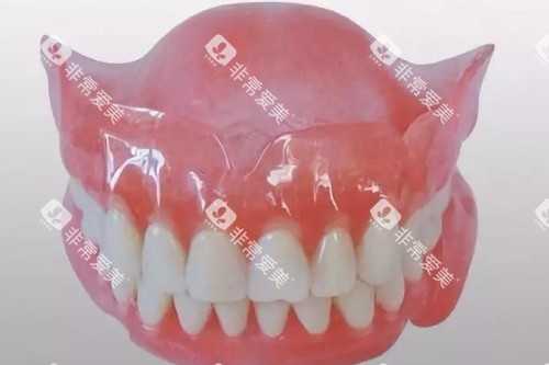 吸附于义齿卡通模型图 吸附于义齿卡通模型图