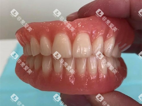 全口吸附性义齿实物图 全口吸附性义齿实物图