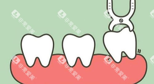 拔牙改善展示图照片
