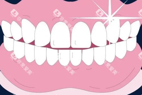 整齐牙齿卡通图