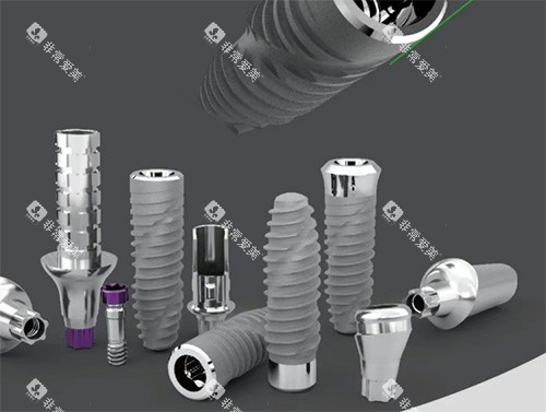 卡尔斯种植牙怎么样 卡尔斯种植牙怎么样