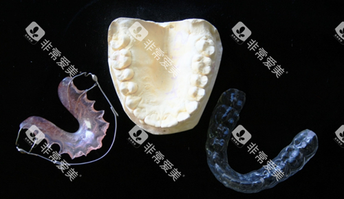 牙齿矫正模型图
