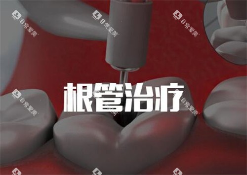 根管治疗卡通图 根管治疗卡通图