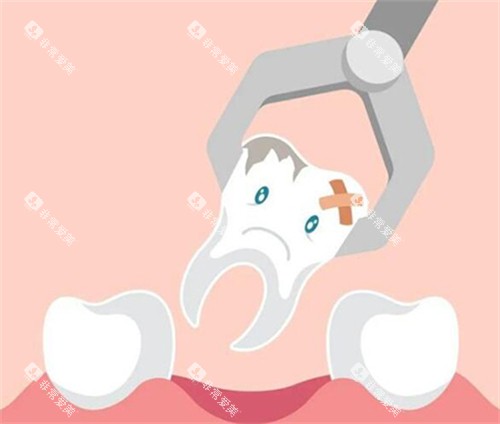 牙齿拔除卡通图 牙齿拔除卡通图