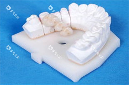 牙齿模型图片展示