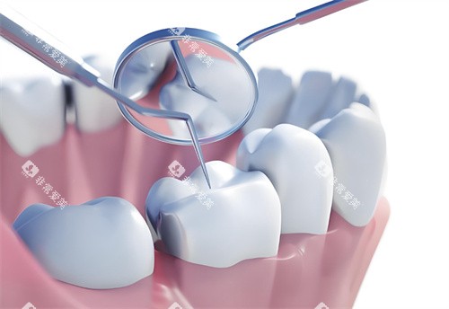 牙齿检查卡通图展示