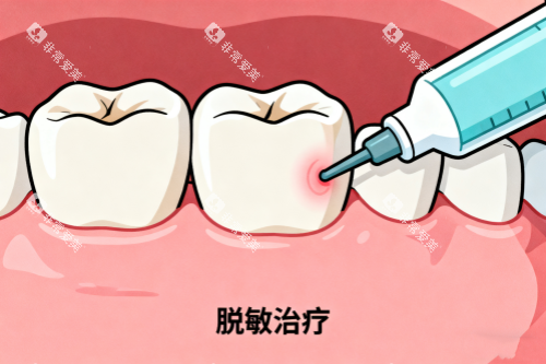 牙齿敏感治疗卡通图 牙齿敏感治疗卡通图