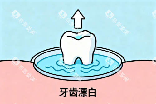 牙齿漂白卡通图 牙齿漂白卡通图