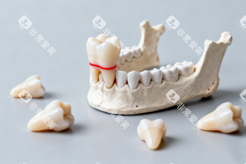 牙齿模型图片一览 牙齿模型图片一览