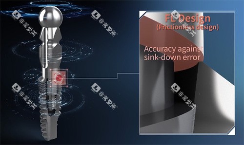 沃兰种植牙植体细节图 沃兰种植牙植体细节图
