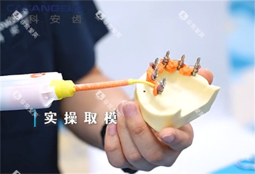 中科安齿种植牙实操取模