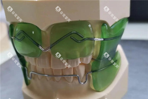 法兰克3矫正器图片