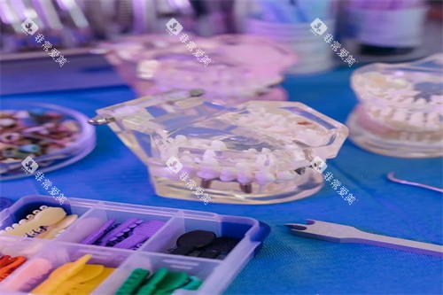 牙齿正畸宣传图