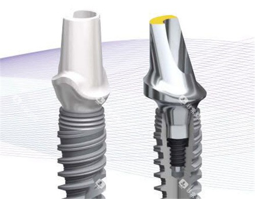 诺贝尔种植牙示意图