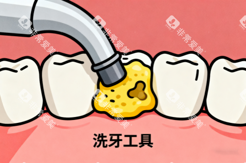 清洗牙齿脏东西展示图