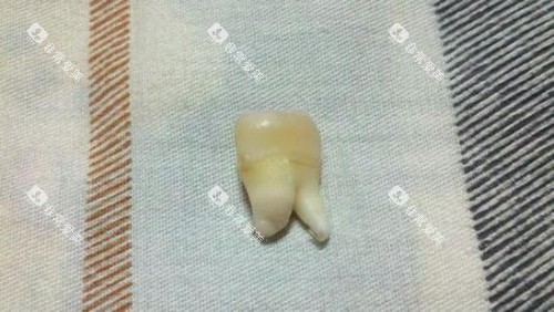 智齿实物展示图