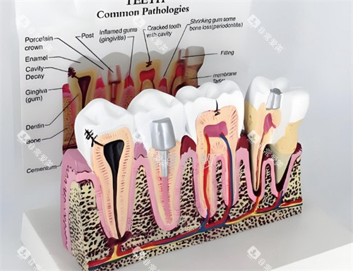 牙齿模型解剖图片