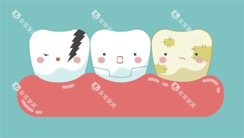 牙齿美白对比卡通图
