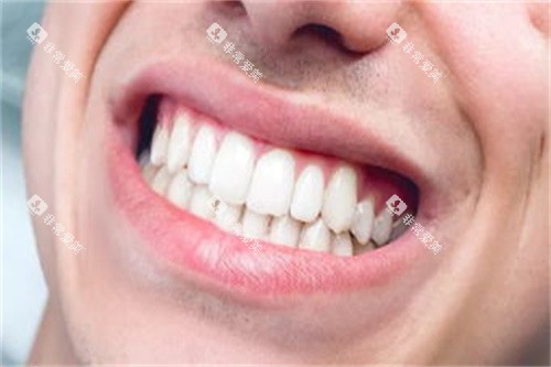 整齐的牙齿图片展示