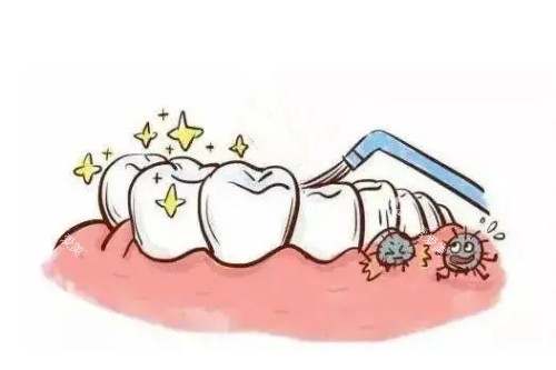 儿牙涂氟卡通图片展示 儿牙涂氟卡通图片展示