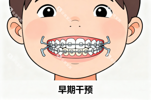 儿牙早期干预卡通图